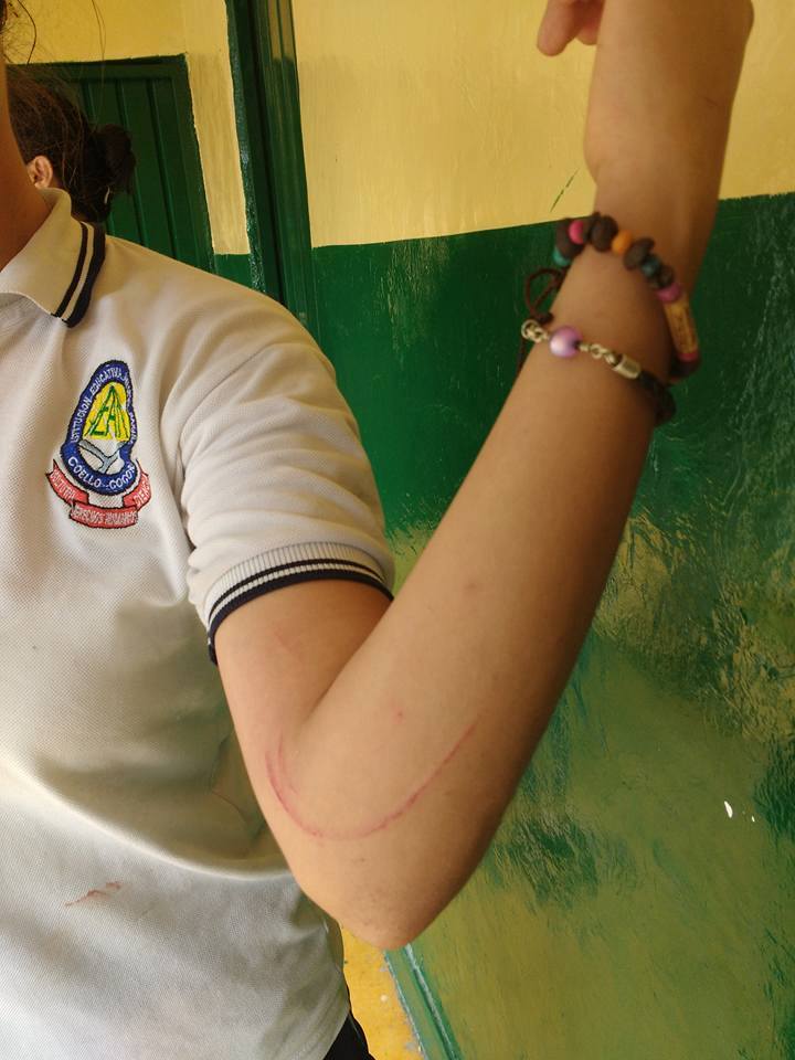 Antimotines de la Policía agredió a estudiantes que realizaban protesta pacífica 3 13282053_1132448050110718_487527302_n
