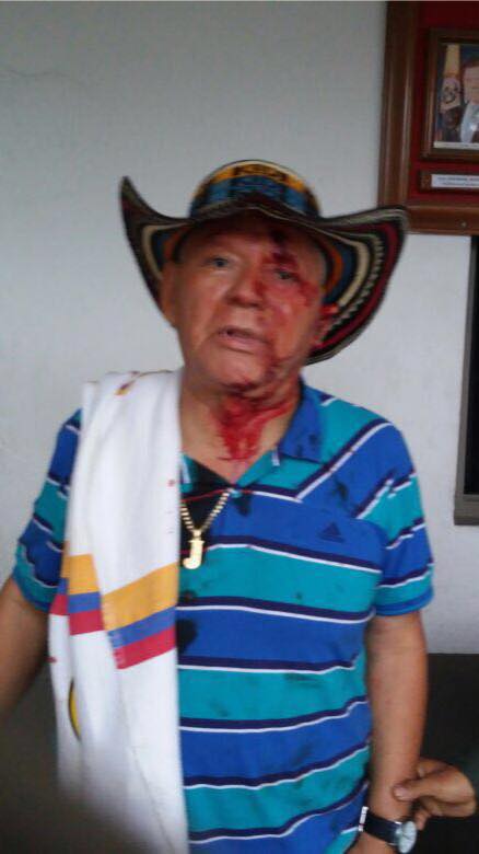 Exsenador Jairo Cuéllar protagonizó delicado accidente de tránsito 3 Jairo Cuéllar